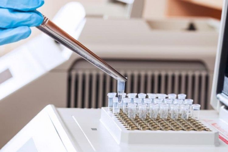 Ilustrasi (shutterstock)